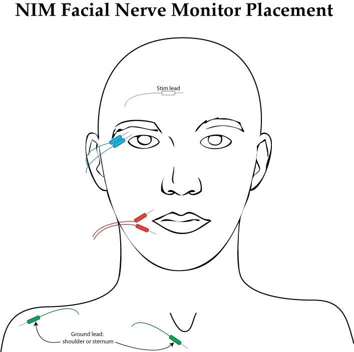 Facial Nerve Monitor 7